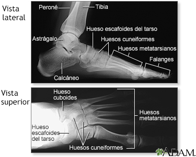 Radiografía del pie normal - Miniatura de ilustración
              