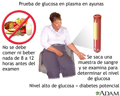 Prueba de glucosa en plasma en ayunas - Miniatura de ilustración
              