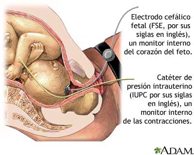 Control Fetal Interno