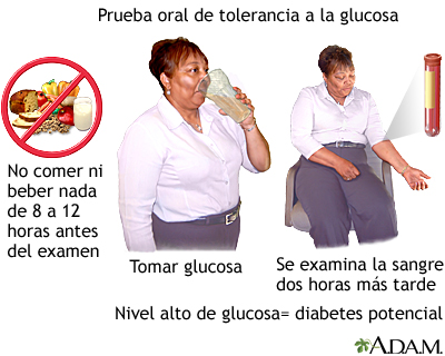 Prueba oral de tolerancia a la glucosa - Miniatura de ilustración
              