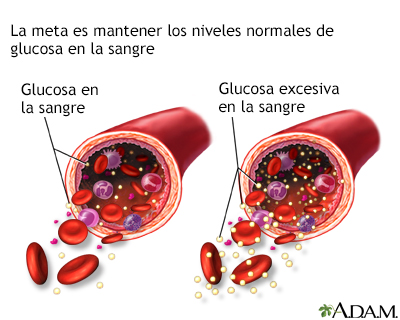 Glucosa en la sangre - Miniatura de ilustración
              