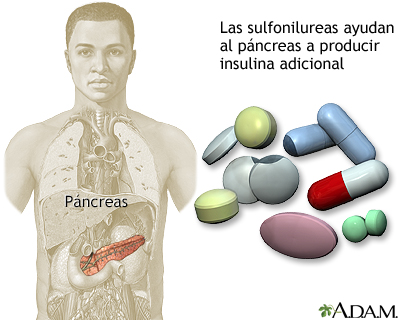 Drogas sulfonilureas - Miniatura de ilustración
              