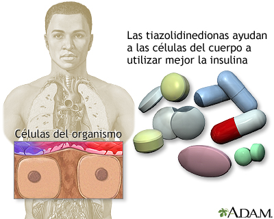 Tiazolidinedionas - Miniatura de ilustración
              