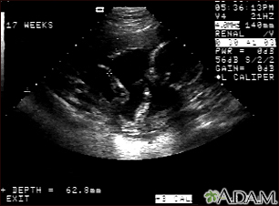 Ultrasonido de un feto normal - brazos y piernas