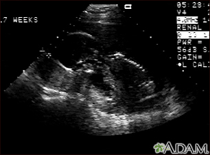 Ultrasonido de un feto normal - vista de perfil - Miniatura de ilustración
              