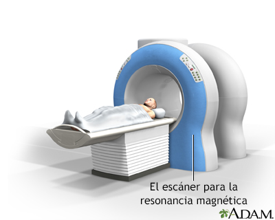 IRM - Miniatura de ilustración
              