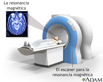 Resonancia magnética de la cabeza