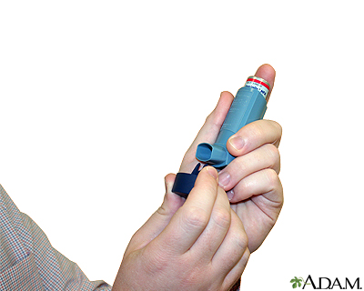 Uso del inhalador de dosis medidas - Serie - paso uno - Miniatura de presentación
              