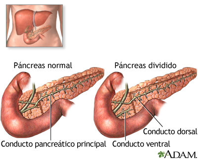 Páncreas dividido - Miniatura de ilustración
              