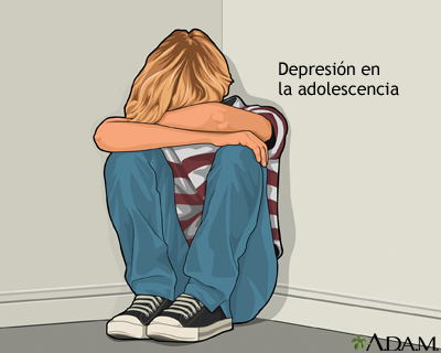 Depresión en el adolescente - Miniatura de ilustración
              