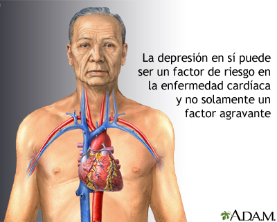 Depresión y enfermedad cardíaca - Miniatura de ilustración
              