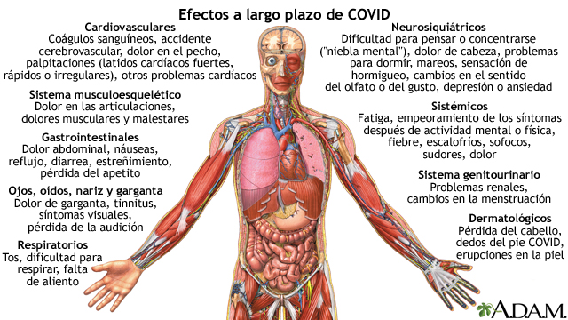 Efectos a largo plazo de COVID - Miniatura de ilustración
              
