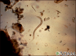 Anquilostoma larva rabditiforme