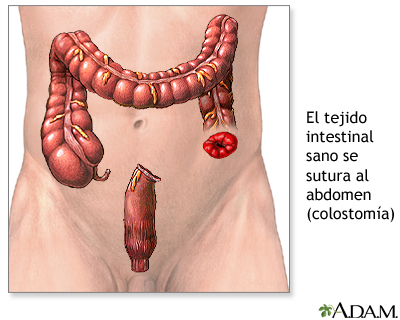 Procedimiento (segunda parte)