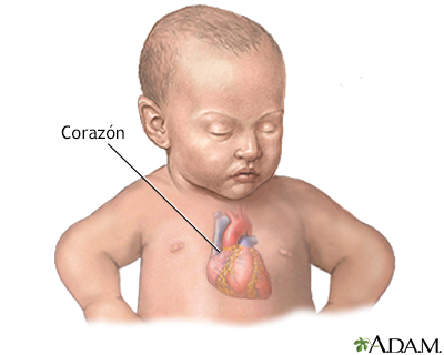 Defecto congénito del corazón - serie - Anatoma del corazn del beb - Miniatura de presentación
              