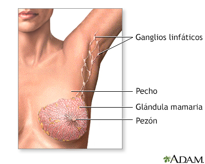 Mastectomía - serie - Anatomía normal - Miniatura de presentación
              