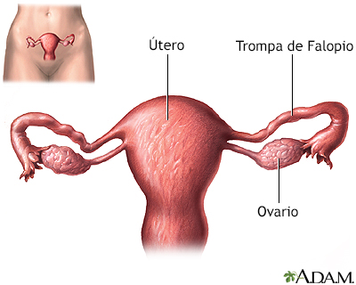 Ligadura de trompas - anatoma uterine