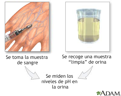 Examen de orina para determinacin del pH