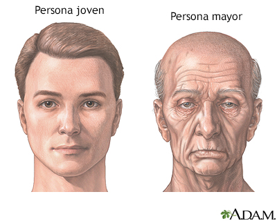 Cambios de la cara por envejecimiento