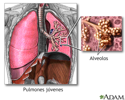 Pulmones y alveolos normales - Miniatura de ilustración
              