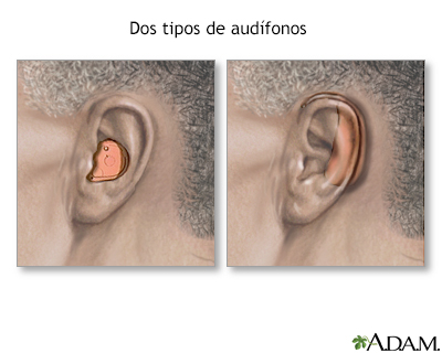 Audífonos - Miniatura de ilustración
              