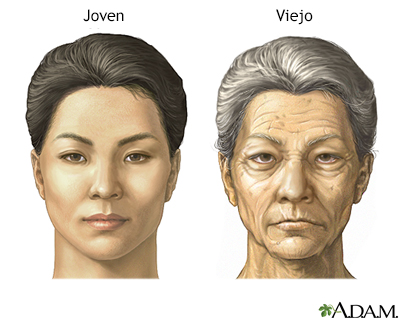 Cambios en la cara por el envejecimiento - Miniatura de ilustración
              