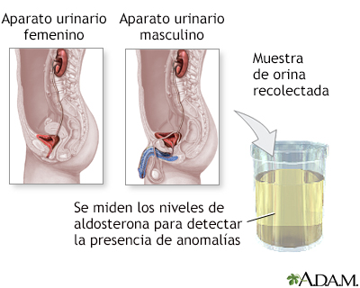 Examen del nivel de aldosterona - Miniatura de ilustración
              