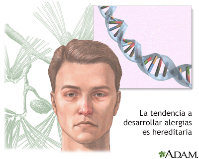 Alergias - Miniatura de ilustración
              