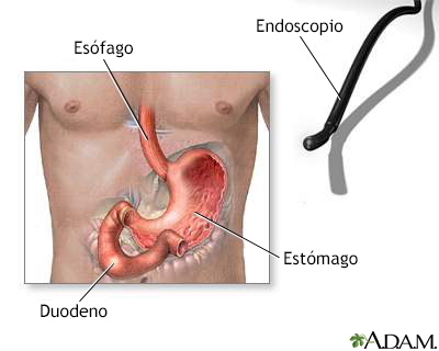 Endoscopia gástrica