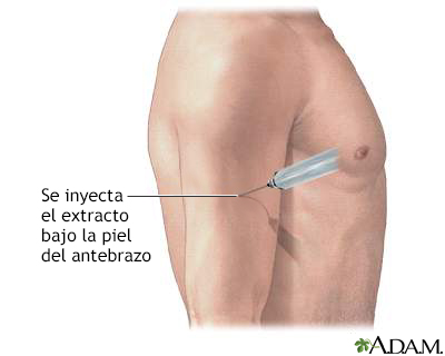 Inyección de antígeno