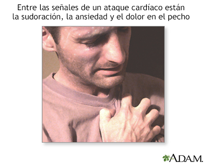 Síntomas de un ataque cardíaco - Miniatura de ilustración
              