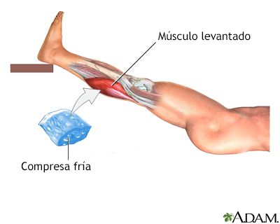 Tratamiento para distensión de la rodilla