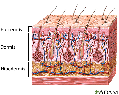 Spanish Hie Multimedia Donovanosis Granuloma Inguinal