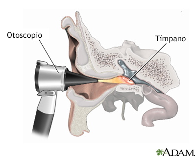 Examen otoscópico del oído - Miniatura de ilustración
              