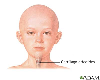 Cartílago cricoides - Miniatura de ilustración
              
