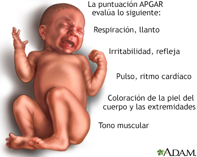 Examen del recién nacido - Miniatura de ilustración
              