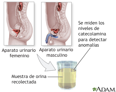 Examen de catecolaminas en orina