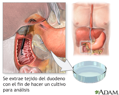 Cultivo del tejido duodenal - Miniatura de ilustración
              