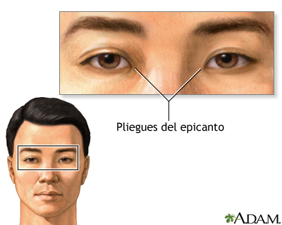 Pliegues del epicanto