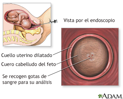 Examen sanguíneo fetal - Miniatura de ilustración
              