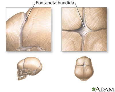 Fontanelas hundidas (vista superior) - Miniatura de ilustración
              
