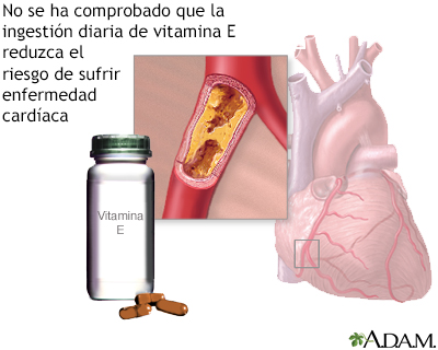 Vitamina E y la enfermedad cardíaca - Miniatura de ilustración
              