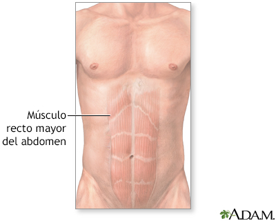Músculos abdominales - Miniatura de ilustración
              