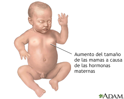 Efectos hormonales en los recién nacidos - Miniatura de ilustración
              