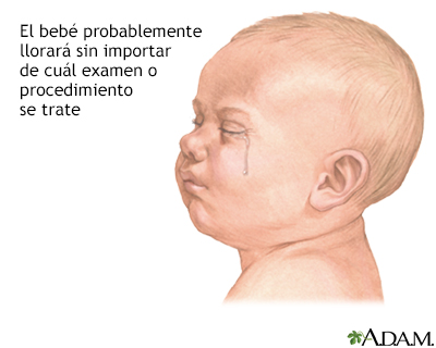 Preparación para un examen o procedimiento en un niño menor de un año - Miniatura de ilustración
              