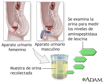 Prueba de aminopeptidasa de leucina en orina - Miniatura de ilustración
              