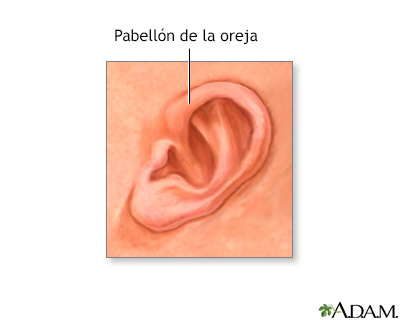 Pabellón auricular de un recién nacido - Miniatura de ilustración
              