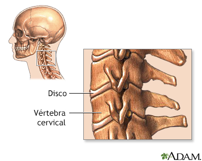Vértebras cervicales - Miniatura de ilustración
              
