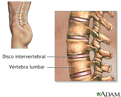 Vértebras lumbares - Miniatura de ilustración
              