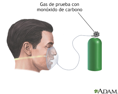 Prueba de difusión pulmonar - Miniatura de ilustración
              